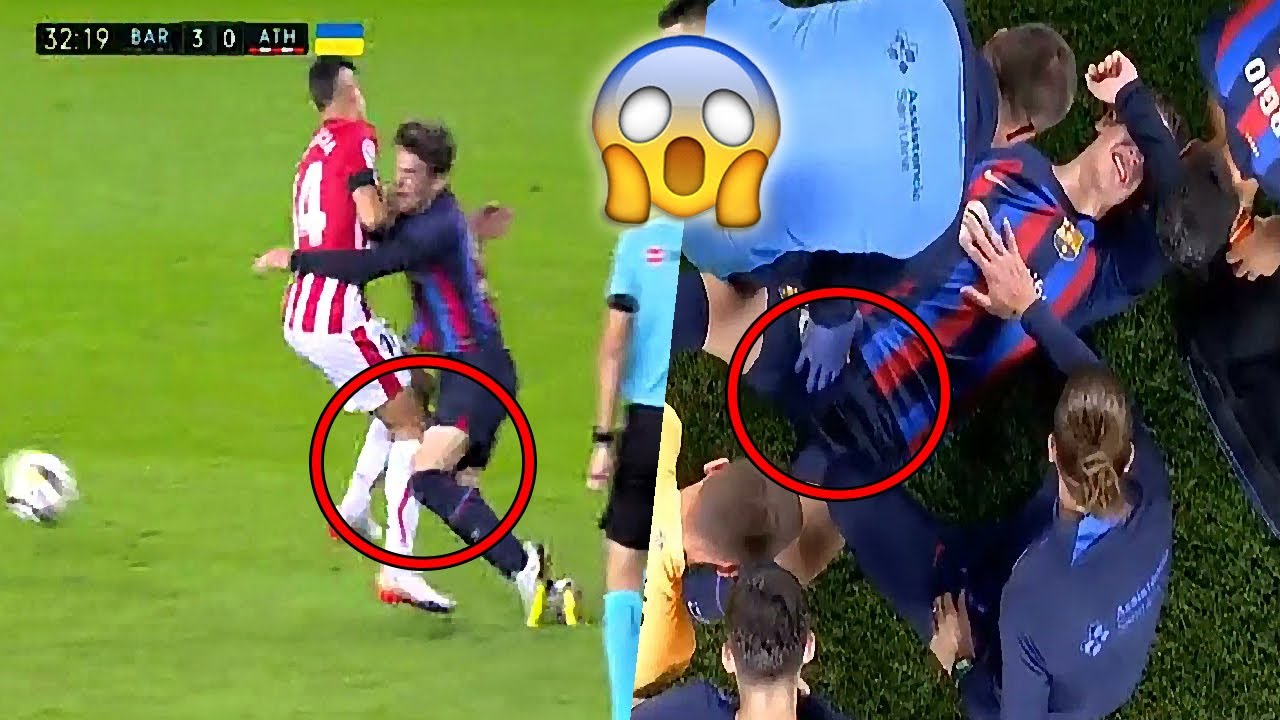 Terrible injury of Barcelona's Gavi